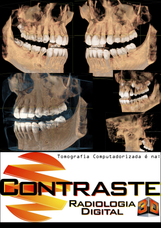 RT: HENRIQUE S. L. GUIMARÃES CRO/SP 96702 CRO CL 16645